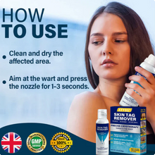 Load image into Gallery viewer, ATTDX® TagRecede Cryo Treatment Spray