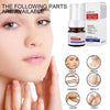 Vitamin C Whitening Freckles Face Cream Remove Melasma Dark Spots Lighten Melanin