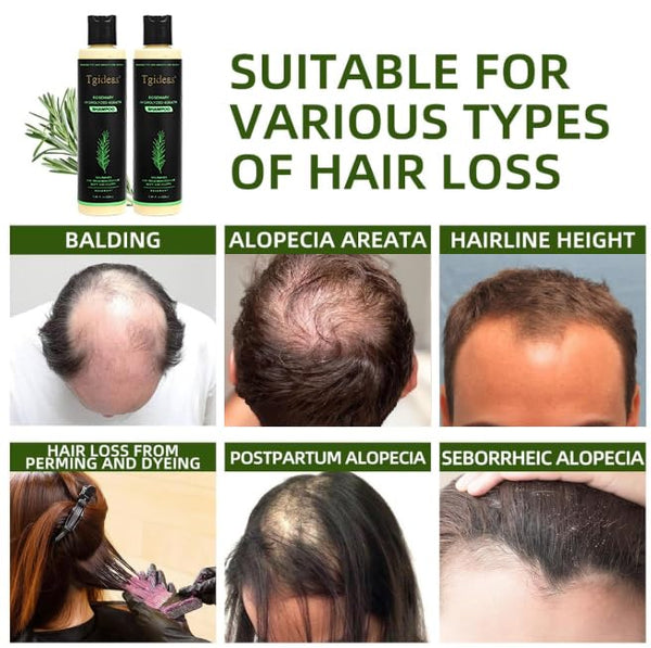 Rosemary Biotin Hair Rescue