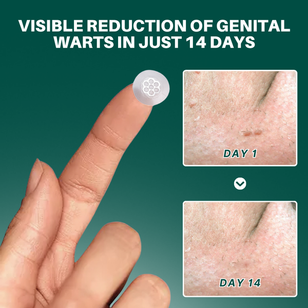 ClearSkin Magnesium MicroPin Wart Patch